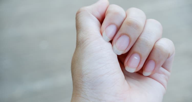 Qué causa las manchas blancas en las uñas2