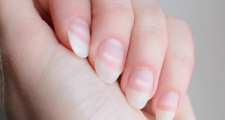 Qué significan realmente las manchas blancas en las uñas