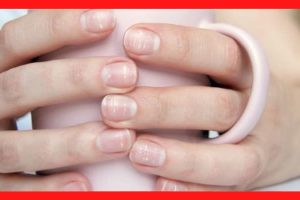 manchas blancas en las uñas